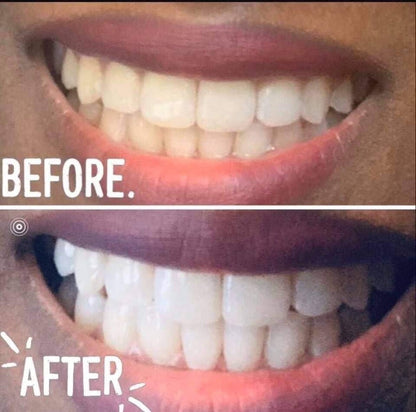 AP24 Whitening Toothpaste