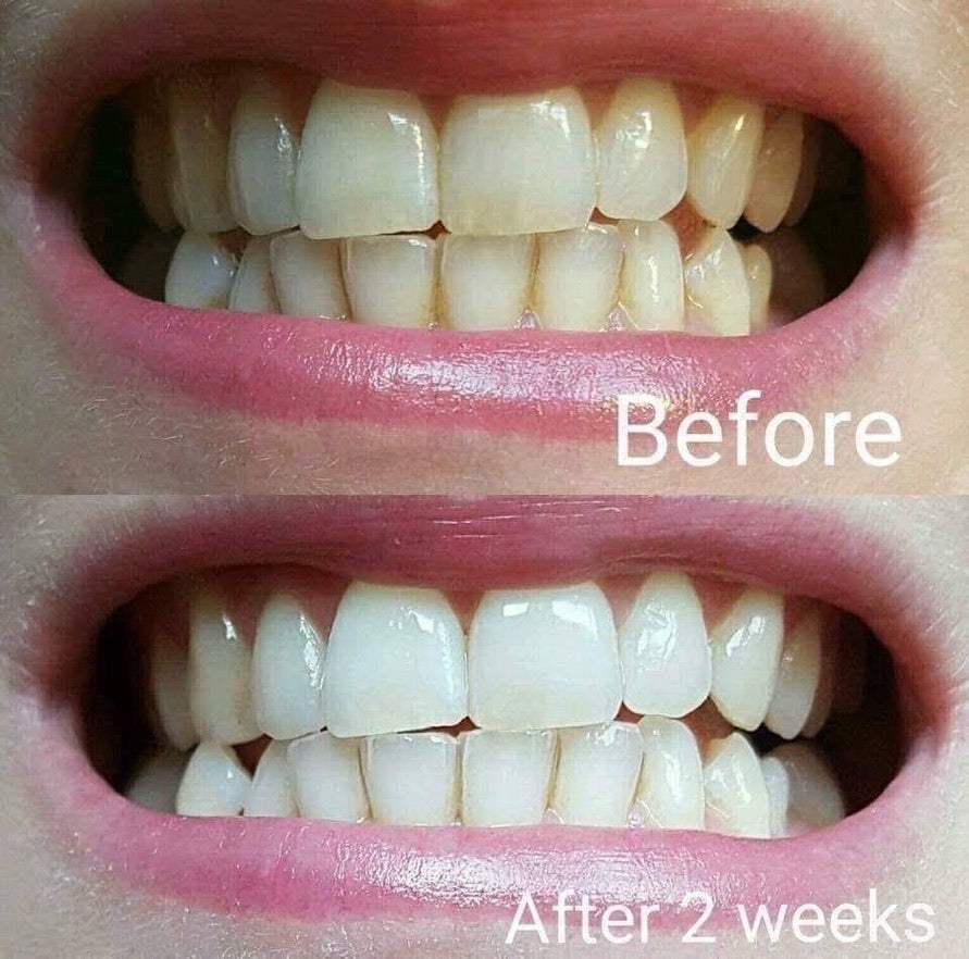 AP24 Whitening Toothpaste