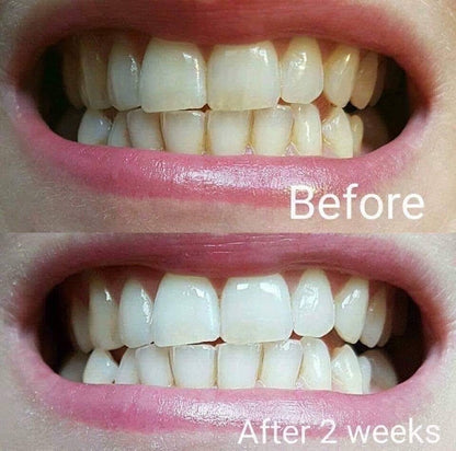 AP24 Whitening Toothpaste