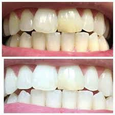 AP24 Whitening Toothpaste